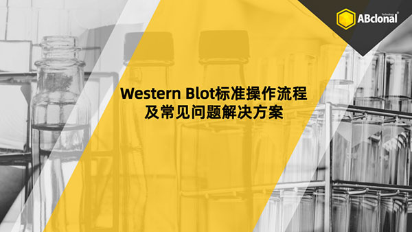 Western Blot (WB)实验技巧及关键环节注意事项